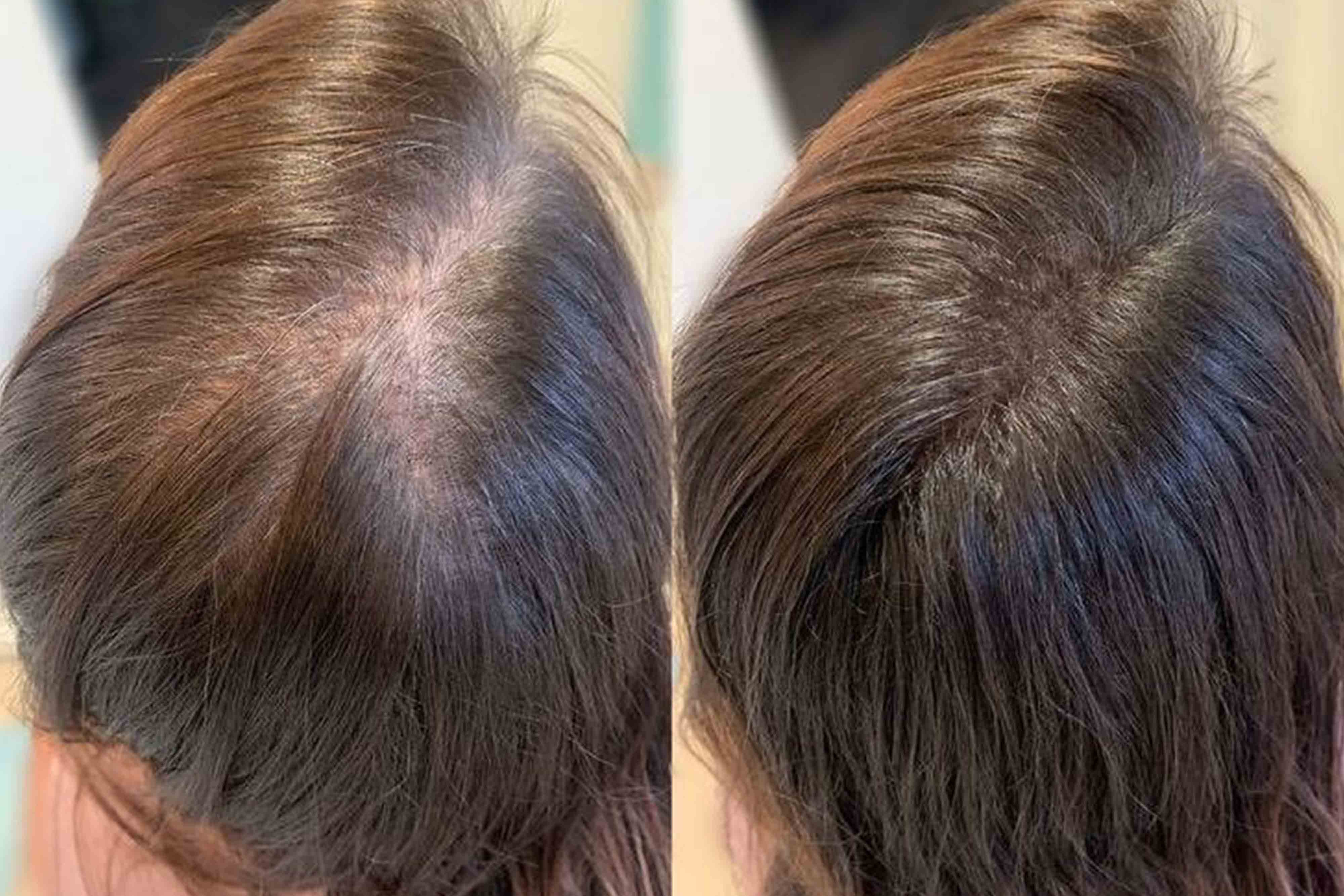 Before and after