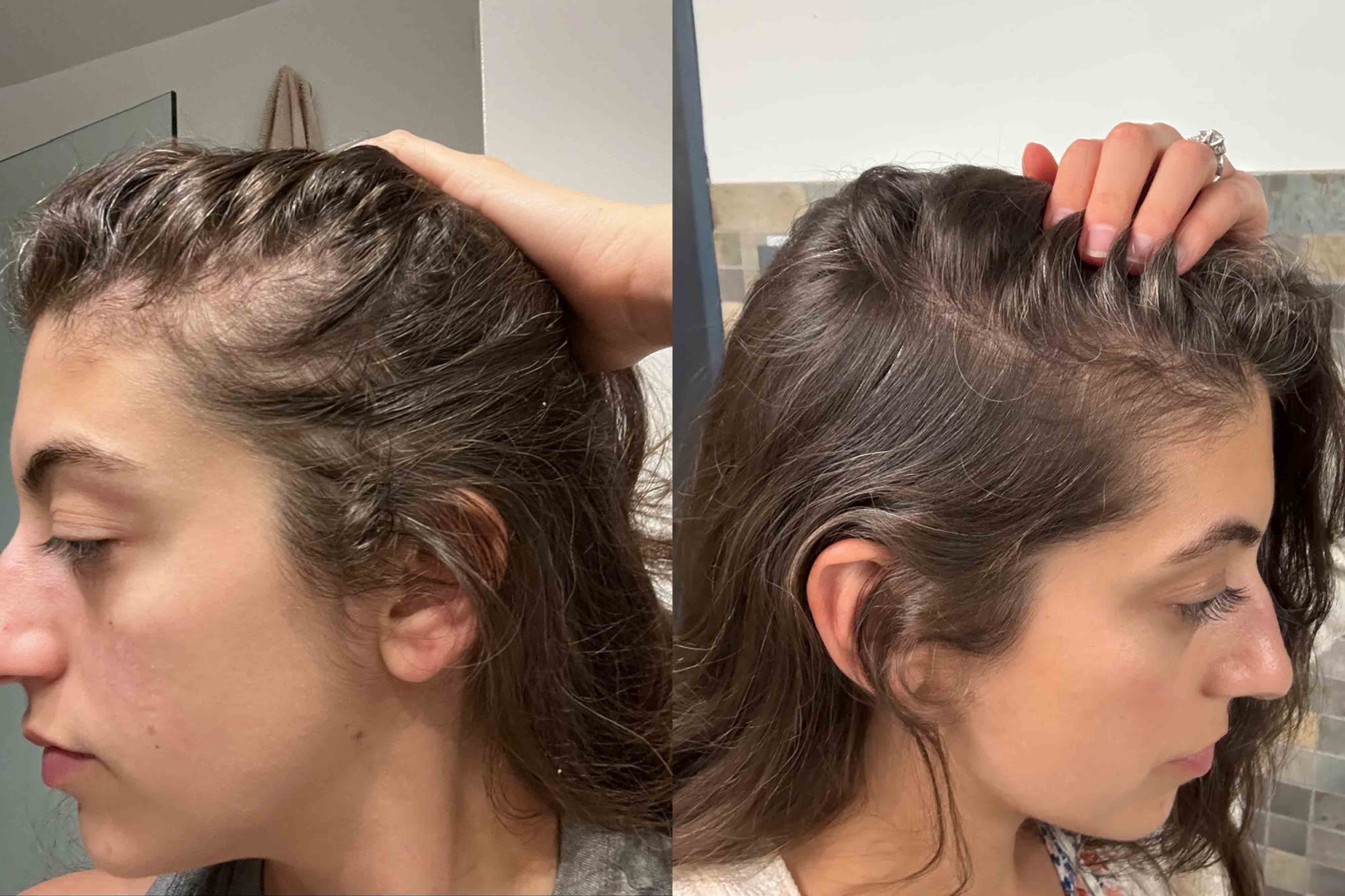 Before and after