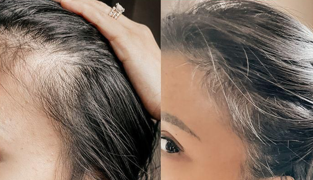 Before and after