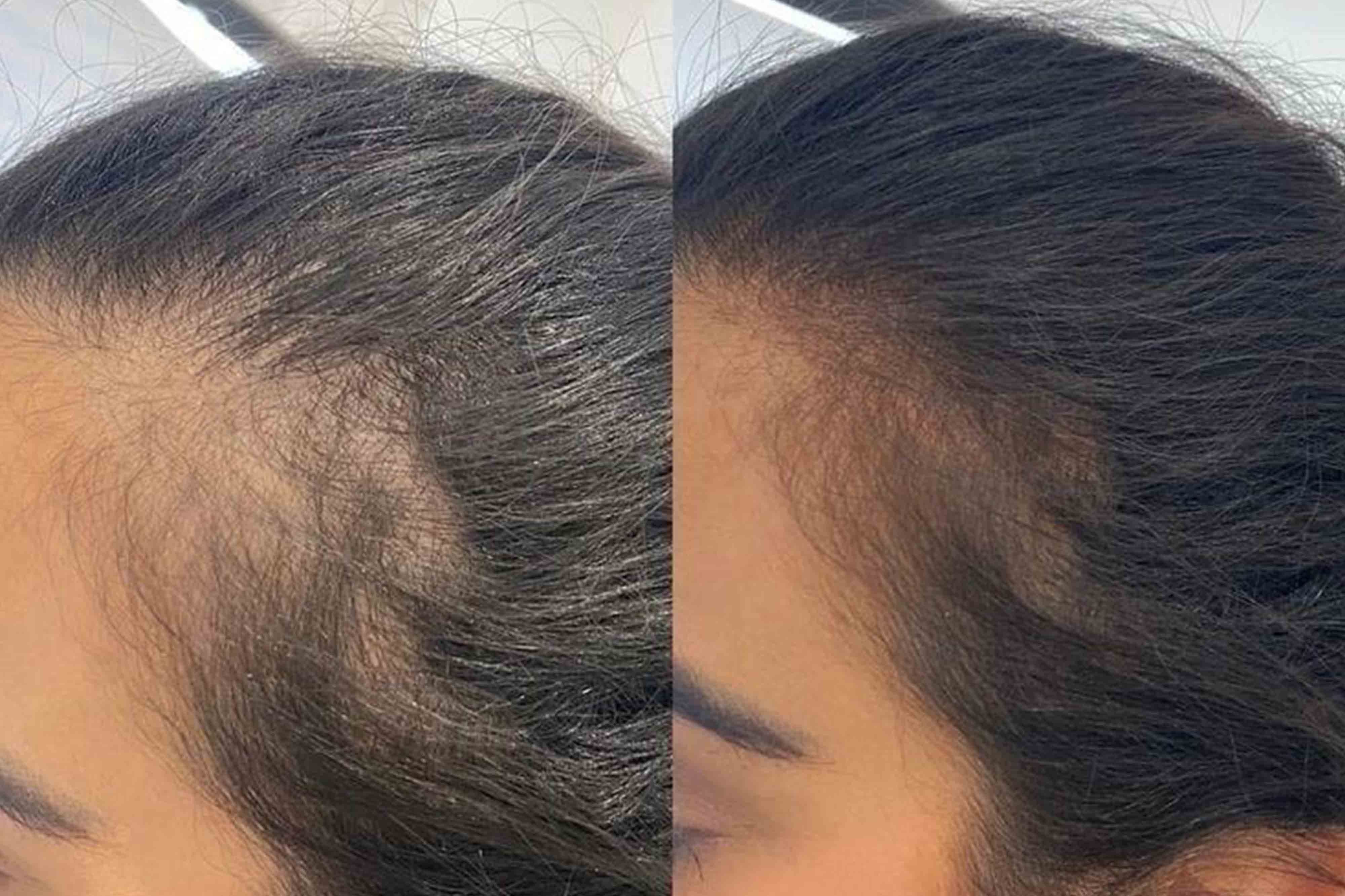 Before and after