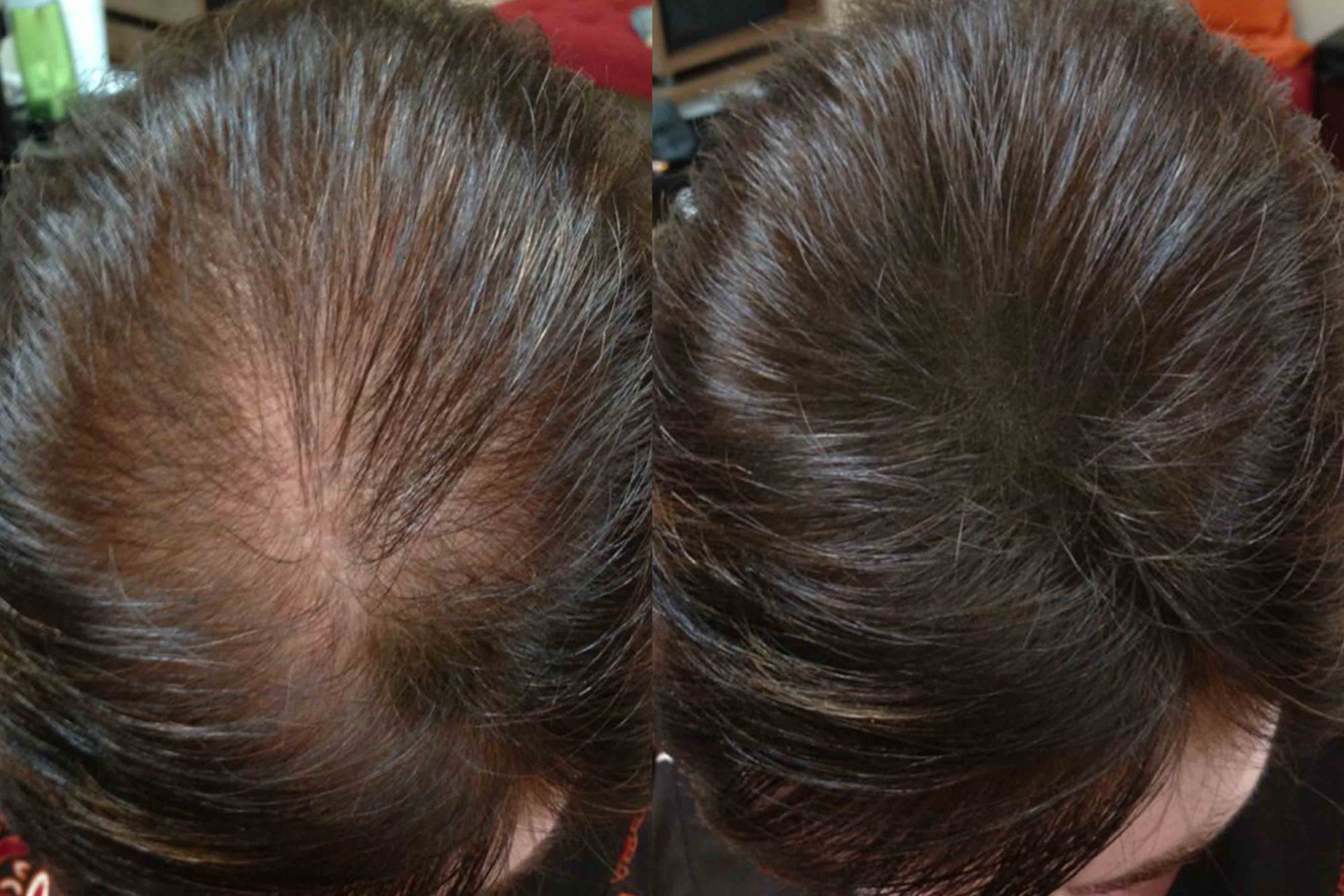 Before and after