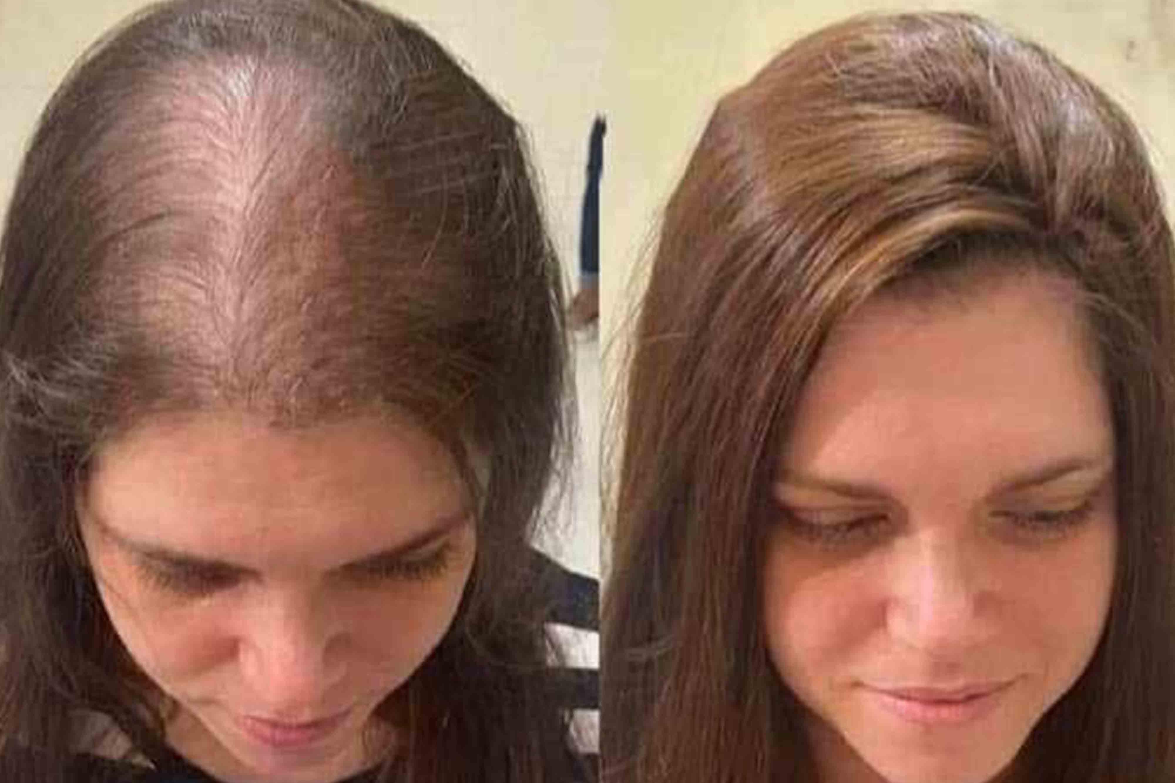 Before and after